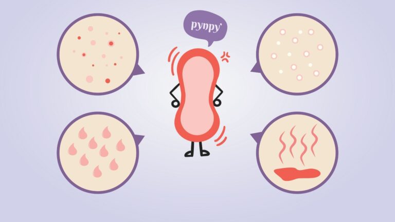 อาการแพ้ผ้าอนามัย