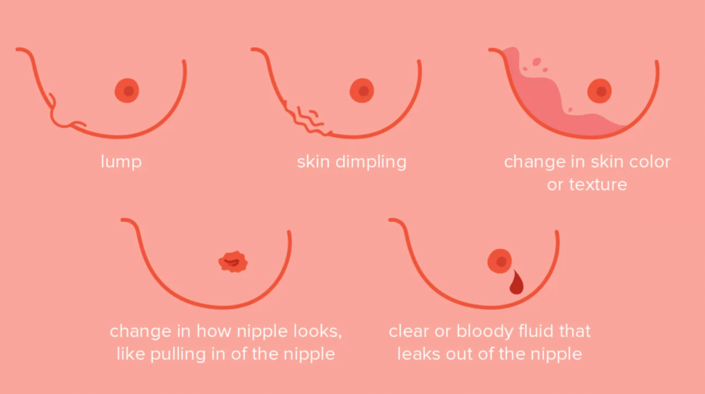 different symptoms of breast cancer