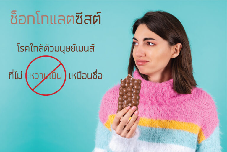 ช็อกโกแลตซีสต์