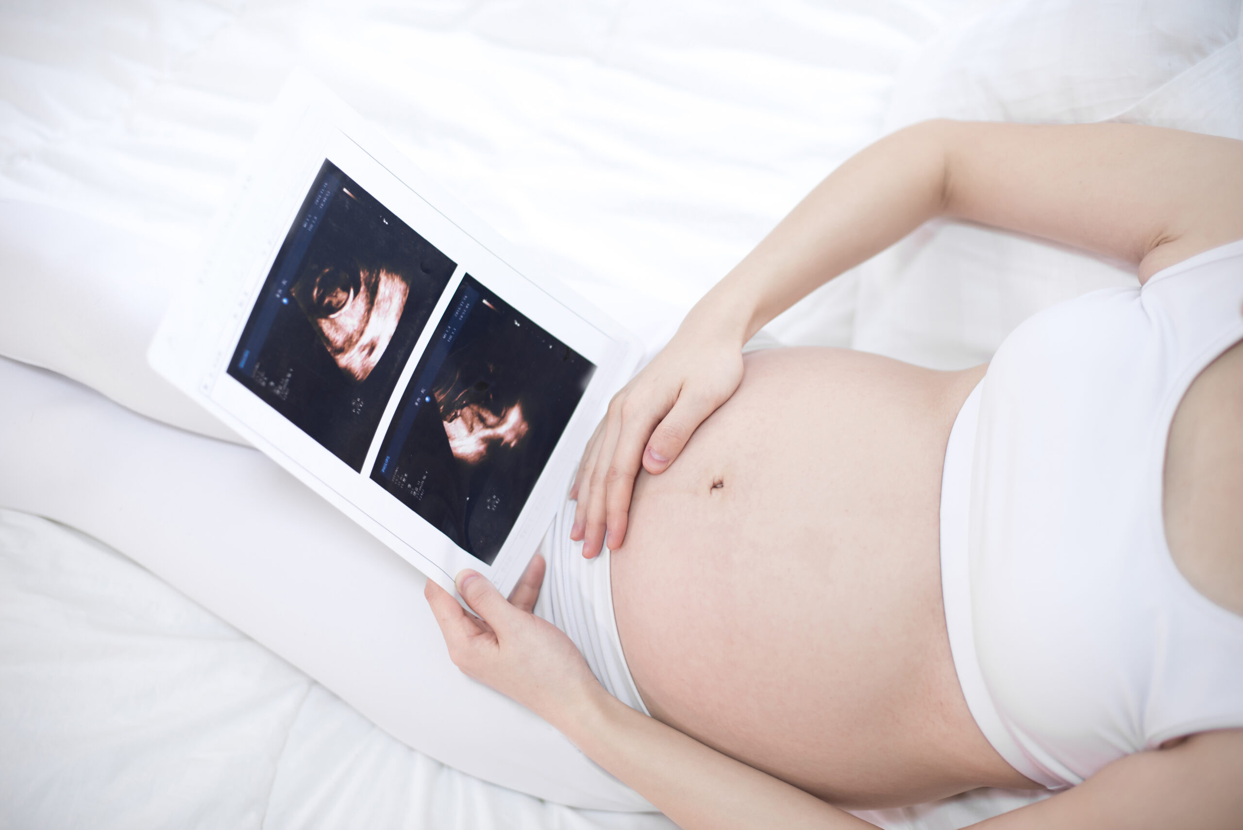 pregnant woman holding ultrasound scan on her tummy