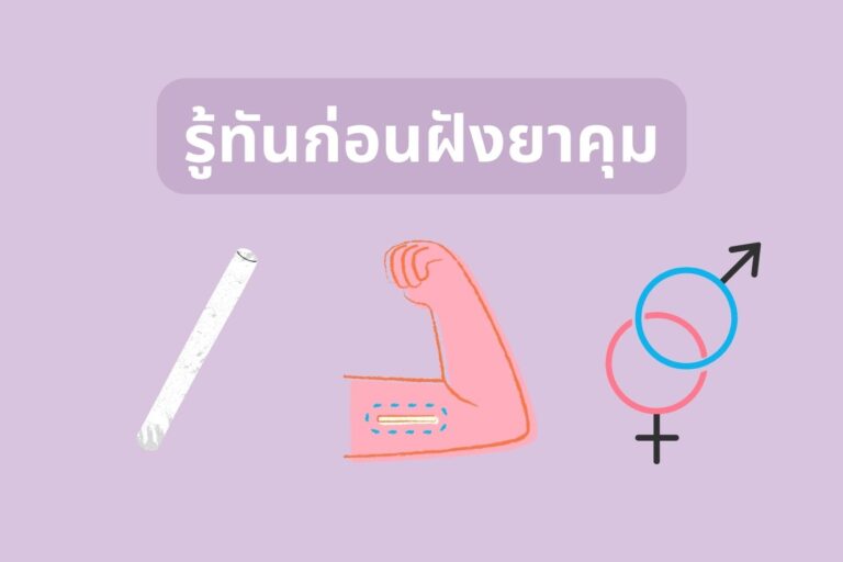 ยาฝังคุมกำเนิด