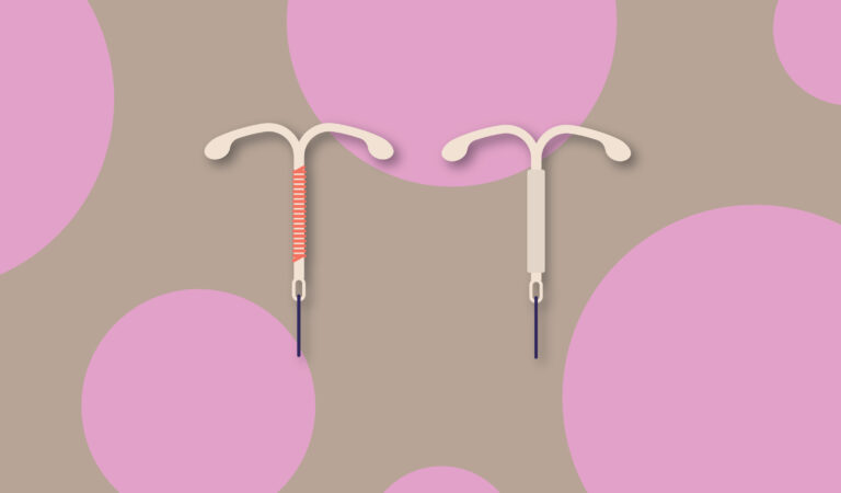 ห่วงคุมกำเนิด-IUD