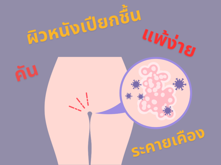 ปัสสาวะเล็ด