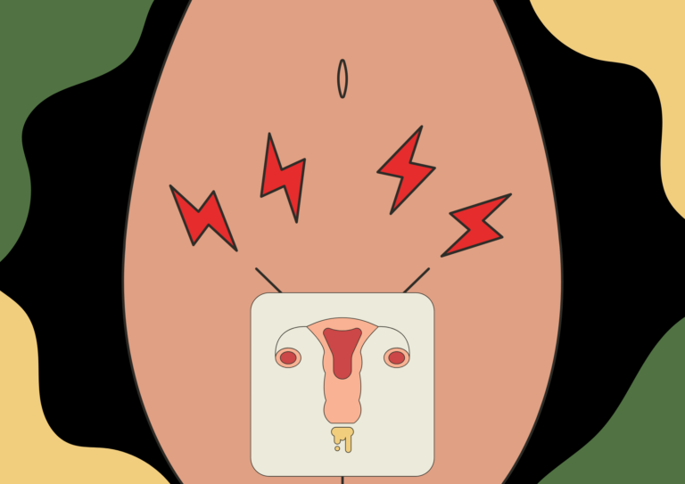 ตกขาวมีกลิ่น